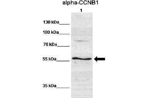 WB Suggested Anti-CCNB1 Antibody  Positive Control: Lane 1:641 µg human NT2 cell line Primary Antibody Dilution: 1:000Secondary Antibody: IRDye 800 CW goat anti-rabbit from Li-COR BioscienceSecondry  Antibody Dilution: 1:00,000Submitted by: Dr. (Cyclin B1 抗体  (C-Term))