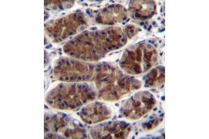 CTGF Antibody (Center) (ABIN392205 and ABIN2841905) immunohistochemistry analysis in formalin fixed and paraffin embedded human stomach tissue followed by peroxidase conjugation of the secondary antibody and DAB staining. (CTGF 抗体  (AA 134-159))