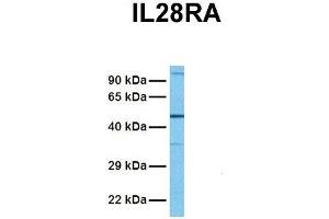 Host:  Rabbit  Target Name:  IL28RA  Sample Tissue:  Human Fetal Lung  Antibody Dilution:  1. (IL28RA 抗体  (N-Term))