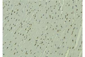 Immunohistochemistry (IHC) image for anti-Zinc Finger, HIT-Type Containing 1 (ZNHIT1) (Internal Region) antibody (ABIN6266140)