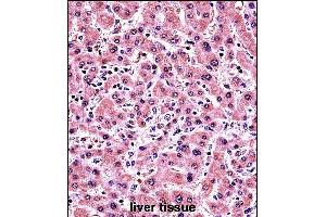 AL Antibody (Center) (ABIN657476 and ABIN2846504) immunohistochemistry analysis in formalin fixed and paraffin embedded human liver tissue followed by peroxidase conjugation of the secondary antibody and DAB staining. (PLAP 抗体  (AA 282-309))