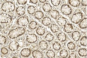 Immunohistochemical analysis of paraffin-embedded Human Colorectal section using Pink1 am2261b. (CDK5 抗体  (AA 160-286))