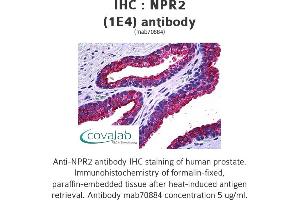 Image no. 1 for anti-Natriuretic Peptide Receptor B/guanylate Cyclase B (Atrionatriuretic Peptide Receptor B) (NPR2) (AA 131-231) antibody (ABIN1723733) (NPR2 抗体  (AA 131-231))