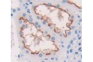 Immunohistochemistry (IHC) image for anti-Solute Carrier Family 12 (Sodium/potassium/chloride Transporters), Member 1 (SLC12A1) (AA 814-1099) antibody (ABIN1869474)
