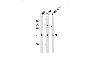All lanes : Anti-GPX7 Antibody (Center) at 1:2000 dilution Lane 1: Hela whole cell lysate Lane 2: THP-1 whole cell lysate Lane 3: RI 8226 whole cell lysate Lysates/proteins at 20 μg per lane. (Glutathione Peroxidase 7 抗体  (AA 73-107))