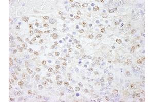 Immunohistochemistry (IHC) image for anti-Polymerase (DNA Directed), lambda (POLL) (AA 525-575) antibody (ABIN7448731) (POLL 抗体  (AA 525-575))