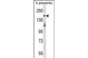 Western blot analysis in human placenta tissue lysates (35ug/lane). (INTS1 抗体  (N-Term))