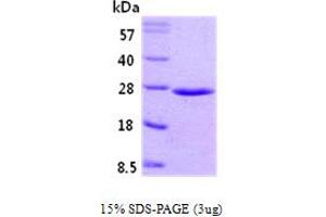 SDS-PAGE (SDS) image for RAB5A, Member RAS Oncogene Family (RAB5A) (AA 1-215) protein (ABIN666700) (RAB5 Protein (AA 1-215))