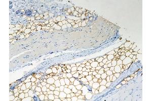 Phospho-Perilipin-1 (Ser522) Antibody at 1/100 staining Rat skin tissue by IHC-P. (PLIN1 抗体  (pSer522))