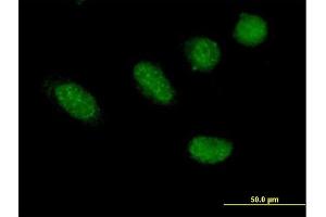 Immunofluorescence of purified MaxPab antibody to GRHL2 on HeLa cell.