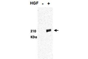 Western blot using MET (phospho Y1349/1356) polyclonal antibody  shows detection of phosphorylated MET. (c-MET 抗体  (pTyr1349, pTyr1356))