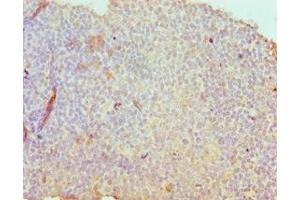 Immunohistochemistry of paraffin-embedded human tonsil tissue using ABIN7171193 at dilution of 1:100 (Syndecan 1 抗体  (AA 25-240))