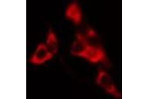 ABIN6275216 staining HuvEc cells by IF/ICC. (LSP1 抗体  (C-Term))