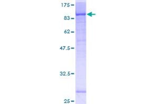 KATNB1 Protein (AA 1-655) (GST tag)