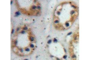 IHC-P analysis of Kidney tissue, with DAB staining. (Claudin 1 抗体  (AA 50-197))