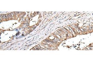 Immunohistochemistry (Paraffin-embedded Sections) (IHC (p)) image for anti-Zinc Finger, HIT-Type Containing 1 (ZNHIT1) antibody (ABIN7245752)