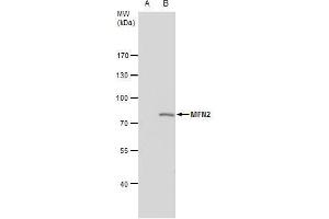 WB Image MFN2 antibody [N1N2], N-term detects MFN2 protein by western blot analysis. (MFN2 抗体  (N-Term))
