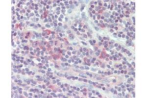Immunohistochemistry (Paraffin-embedded Sections) (IHC (p)) image for anti-Killer Cell Lectin-Like Receptor Subfamily C, Member 1 (KLRC1) (AA 1-30) antibody (ABIN1812380)