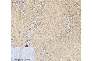 Immunohistochemical analysis of paraffin-embedded human liver tissue. (STS 抗体  (AA 10-90))