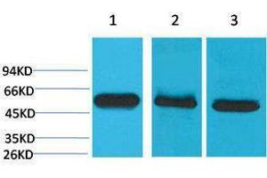Western Blotting (WB) image for anti-Caspase 8 (CASP8) antibody (ABIN3181527) (Caspase 8 抗体)