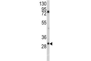 Western blot analysis of SLUG antibody and A2058 lysate. (SLUG 抗体  (AA 1-30))