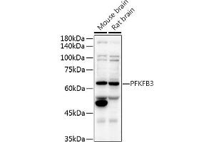 Western blot analysis of extracts of various cell lines, using PFKFB3 antibody (ABIN6129841, ABIN6145485, ABIN6145487 and ABIN6222692) at 1:500 dilution. (PFKFB3 抗体  (AA 400-500))