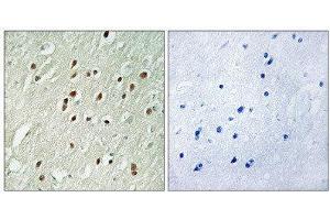 Immunohistochemistry (IHC) image for anti-Centrobin, Centrosomal BRCA2 Interacting Protein (CNTROB) (Internal Region) antibody (ABIN1851052) (CNTROB 抗体  (Internal Region))