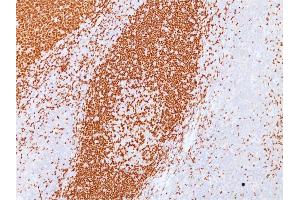 Formalin-fixed, paraffin-embedded human Tonsil stained with PAX5 Mouse Monoclonal Antibody (PAX5/3735). (PAX5 抗体  (AA 235-382))
