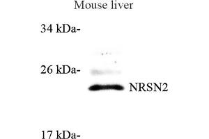 Western blot analysis of NRSN2 (ABIN7074806) at dilution of 1: 500 (NRSN2 抗体)
