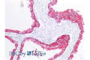 Immunohistochemistry staining of human prostate (paraffin sections) using anti-cytokeratin 19 (A53-B/A2). (Cytokeratin 19 抗体)