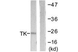 Western Blotting (WB) image for anti-Thymidine Kinase 1, Soluble (TK1) (AA 1-50) antibody (ABIN2888706) (TK1 抗体  (AA 1-50))