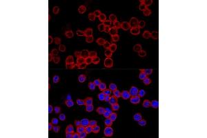 Immunofluorescence analysis of MCF7 cells using Caspase-1 Rabbit pAb (ABIN3021170, ABIN3021171, ABIN3021172 and ABIN6214049) at dilution of 1:150 (40x lens). (Caspase 1 抗体  (AA 1-311))