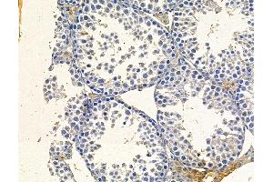 ABIN7095040 and ABIN7099096 at 1/100 staining mouse testis tissue by IHC-P. (SEC24B 抗体)