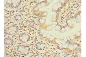Immunohistochemistry of paraffin-embedded human small intestine tissue using ABIN7152386 at dilution of 1:100 (FCHSD2 抗体  (AA 1-290))