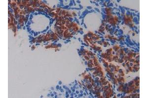 DAB staining on IHC-P; Samples: Mouse Ovary Tissue (Fibulin 5 抗体  (AA 170-243))