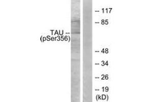 Western blot analysis of extracts from 293 cells treated with serum 10% 15', using Tau (Phospho-Ser356) Antibody. (tau 抗体  (pSer673))