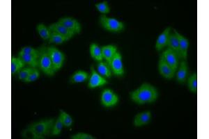 Immunofluorescence staining of HepG2 cells with ABIN7151491 at 1:133, counter-stained with DAPI. (NBC4 抗体  (AA 1071-1137))