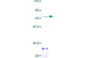 LDLRAP1 Protein (AA 1-263) (GST tag)