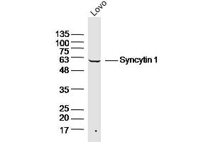 LOVO lysates probed with Syncytin 1 Polyclonal Antibody, Unconjugated  at 1:300 dilution and 4˚C overnight incubation.
