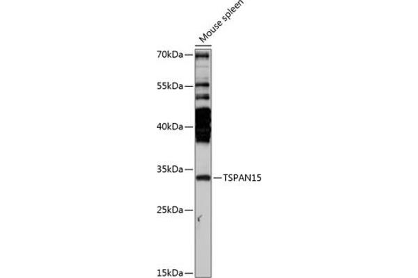 Tetraspanin 15 抗体  (AA 110-220)