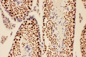 Immunohistochemistry (IHC) image for anti-Breast Cancer 1 (BRCA1) (AA 1661-1863) antibody (ABIN3044313)