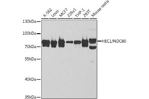 Western blot analysis of extracts of various cell lines, using HEC1/HEC1/NDC80 antibody (ABIN6131748, ABIN6144439, ABIN6144441 and ABIN6221060) at 1:1000 dilution. (NDC80 抗体  (AA 343-642))