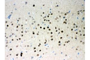 Anti- Parkin Picoband antibody, IHC(P) IHC(P): Rat Brain Tissue (Parkin 抗体  (AA 23-416))