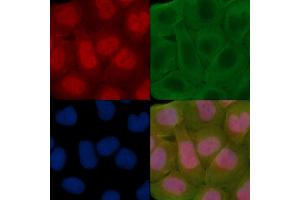 ABIN7095311 and ABIN7099368 staining Hela cells(30 min of UV treatment) by IF/ICC.