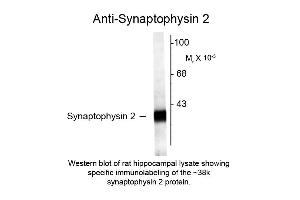 Western blot of Anti-Synaptophysin 2 (Rabbit) Antibody - 612-401-E36 Western Blot of Rabbit anti-Synaptophysin 2 antibody. (Synaptophysin 2 抗体  (C-Term))