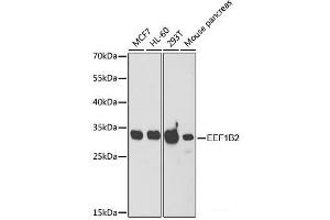 Western blot analysis of extracts of various cell lines using EEF1B2 Polyclonal Antibody at dilution of 1:1000. (EEF1B2 抗体)