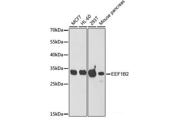 EEF1B2 抗体