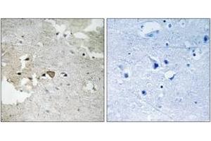 Immunohistochemistry analysis of paraffin-embedded human brain, using AXL (Phospho-Tyr691) Antibody. (AXL 抗体  (pTyr691))