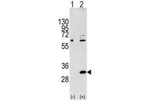 Image no. 2 for anti-Eukaryotic Translation Initiation Factor 4E Family Member 2 (EIF4E2) (N-Term) antibody (ABIN357298) (EIF4E2 抗体  (N-Term))