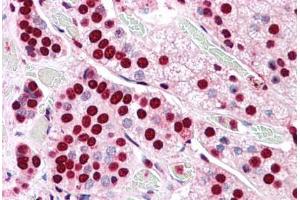 Human Adrenal: Formalin-Fixed, Paraffin-Embedded (FFPE) (COMT 抗体  (Internal Region))